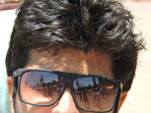 duracion de una protesis capilar