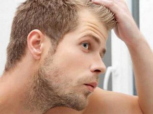 Peluca o prótesis capilar