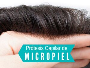prótesis capilares de micropiel