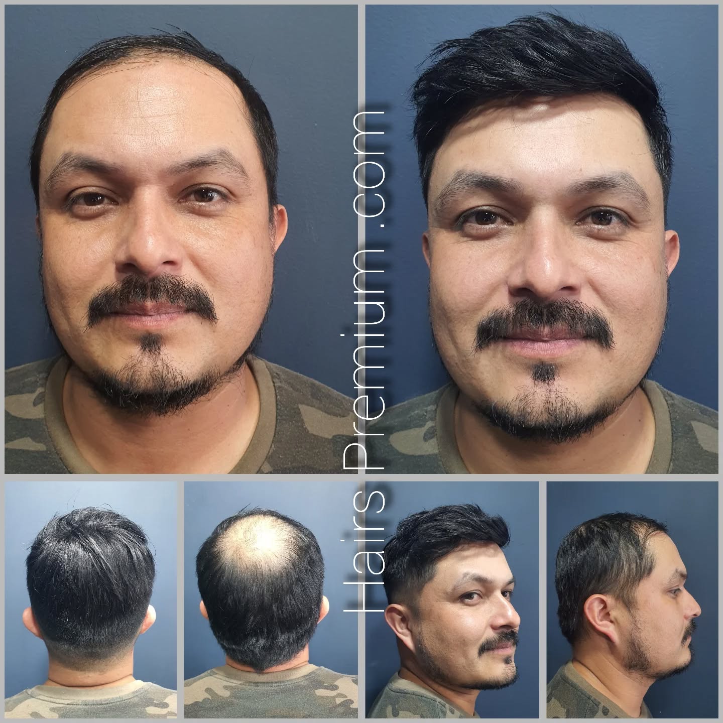 Cortes de cabello bajitos para hombres 🥇【para lucir más altos】