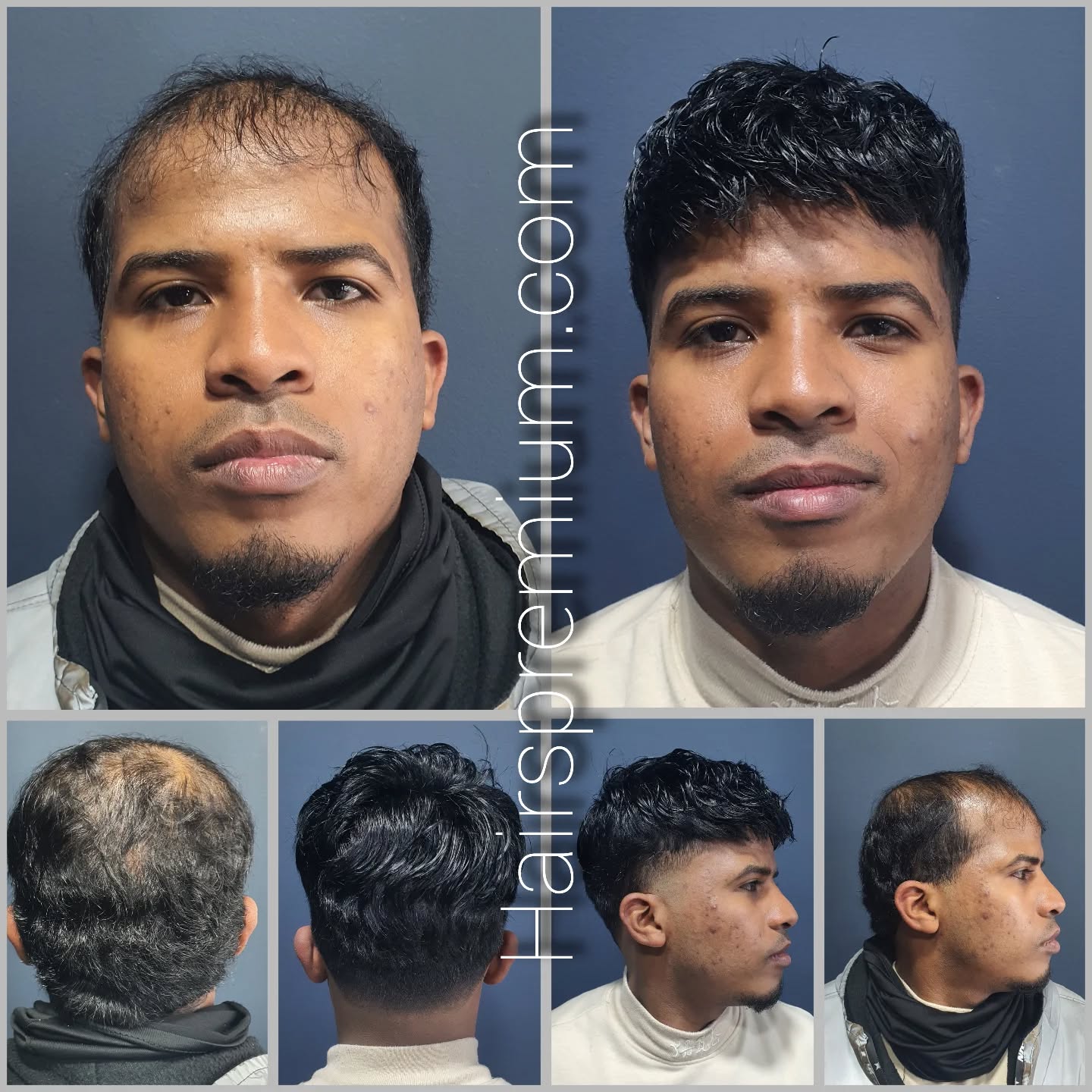 Cortes de cabello bajitos para hombres 🥇【para lucir más altos】